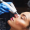 hydrafacial